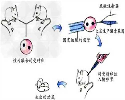 广州代孕_广东第三代试管PGD可以筛选哪些遗传性疾病